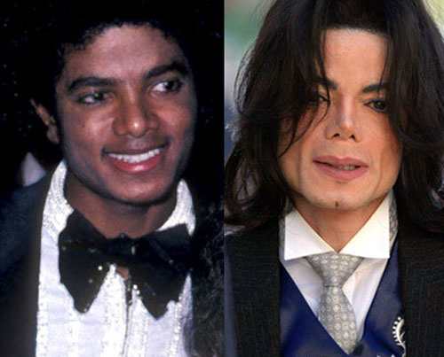 Майкл Джексон до и после пластической операции
